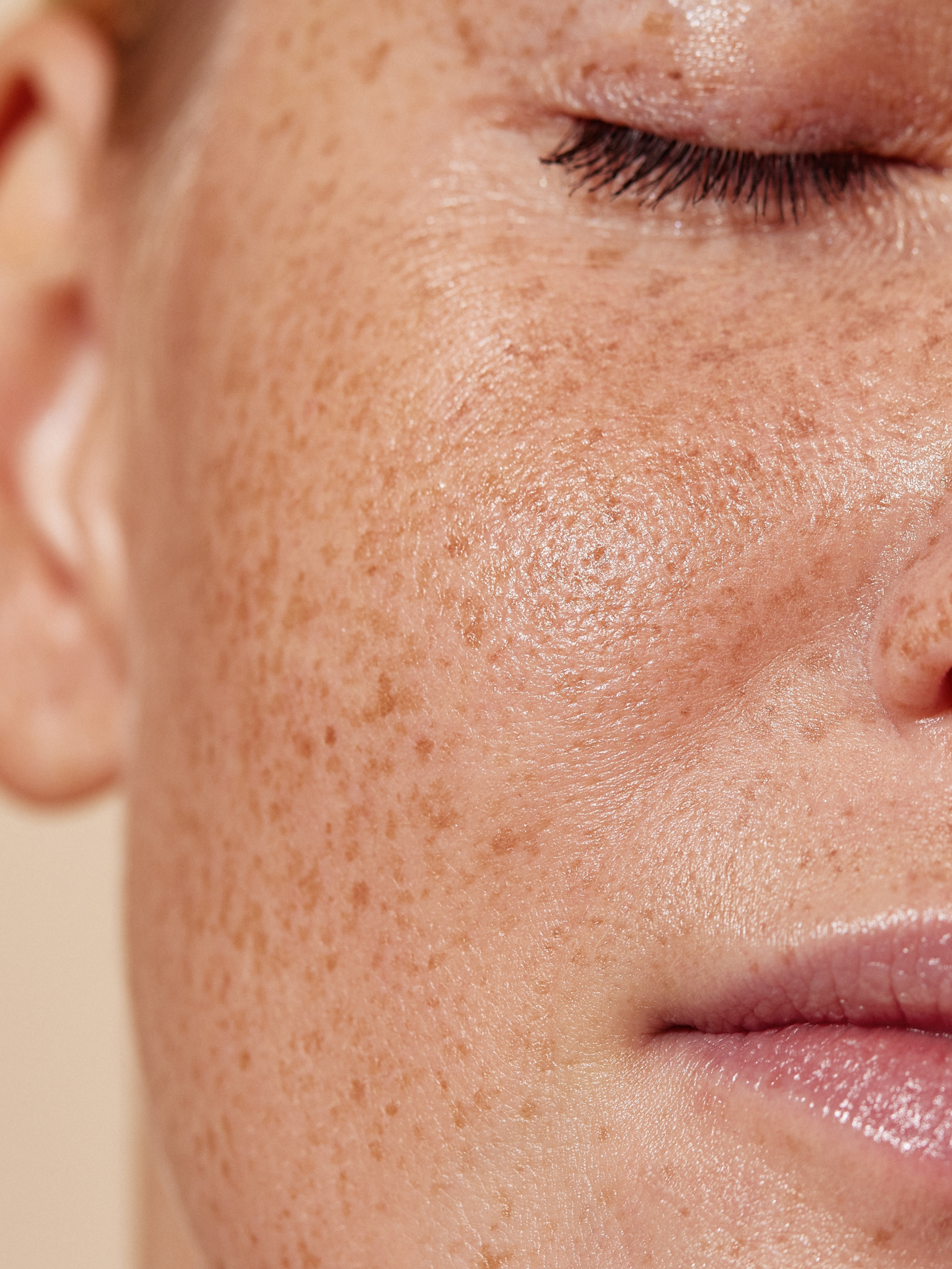 New Study Reveals Benefits of Altrient Glutathione for Tackling Skin Redness and Hyperpigmentation